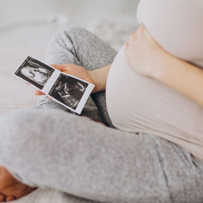 Femme enceinte assise avec échographie dans le main